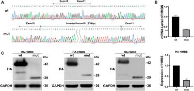 Functional and structural analysis of a novel splice site HMBS variant in a Chinese AIP patient